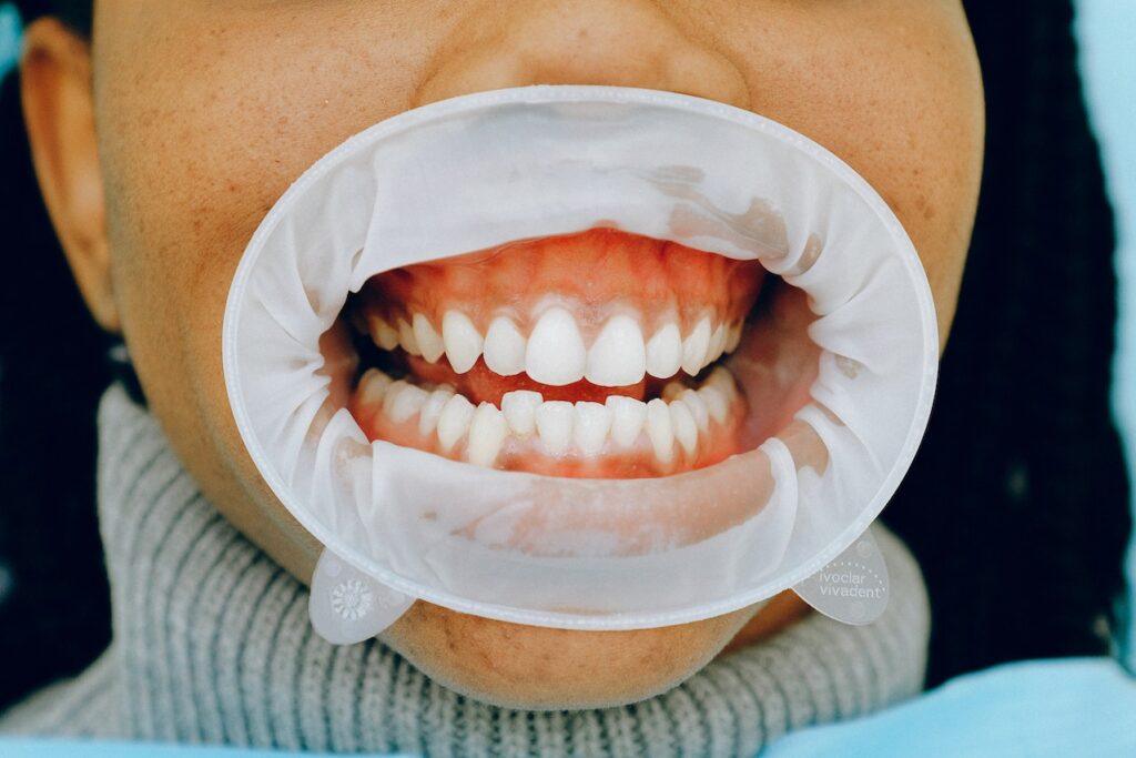 Oral Health Oral Health Regina