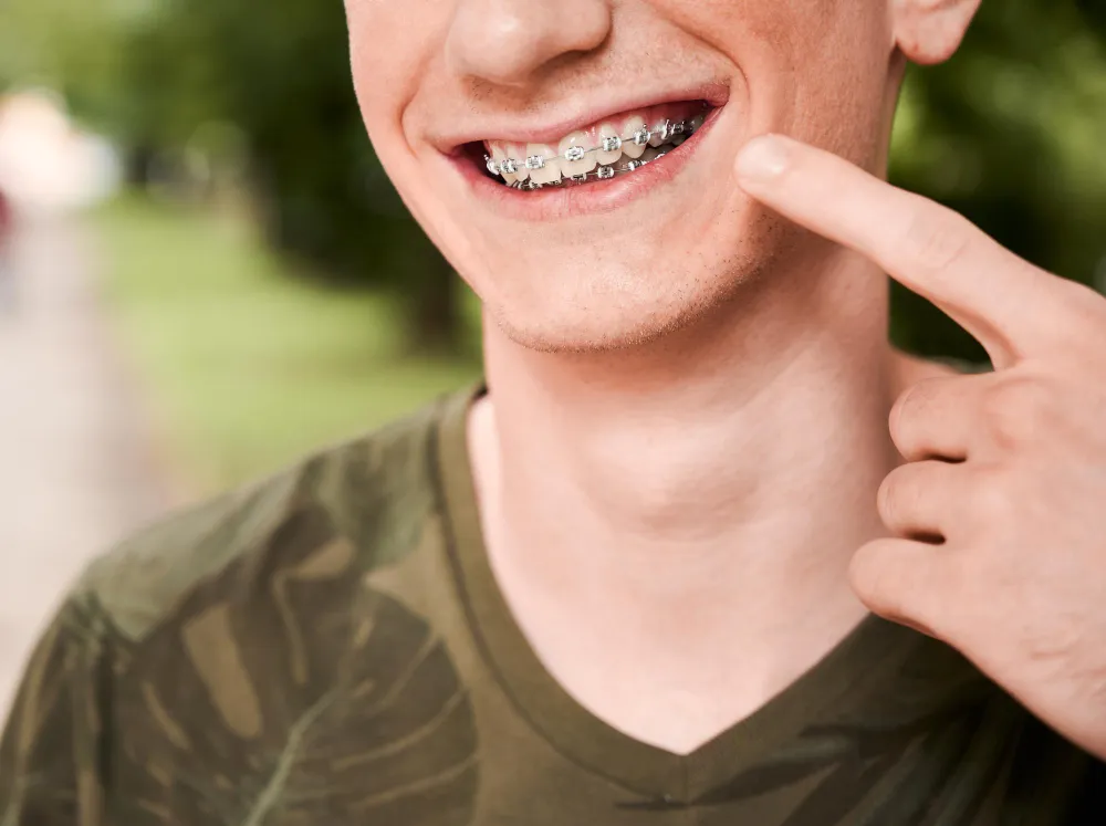 orthodontics for adults 2 orthodontics for adults