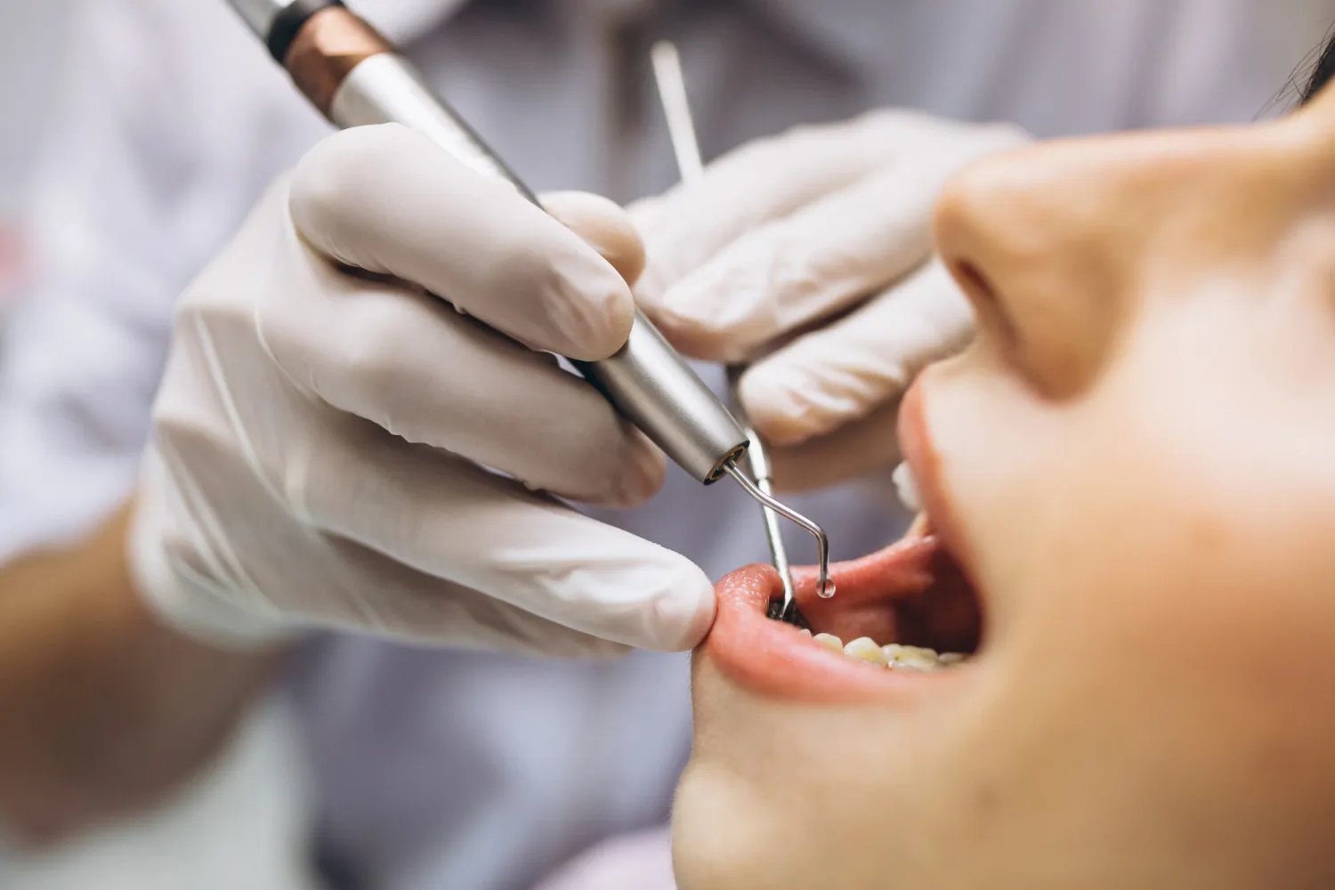 Root Canal Treatment Root Canal Treatment