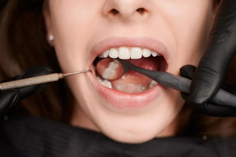 Tooth Staining Vaping vs. Smoking