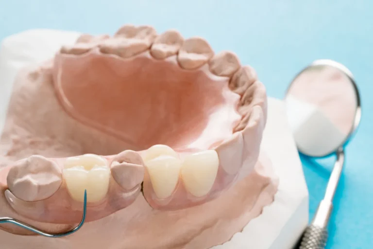 benefits of dentures