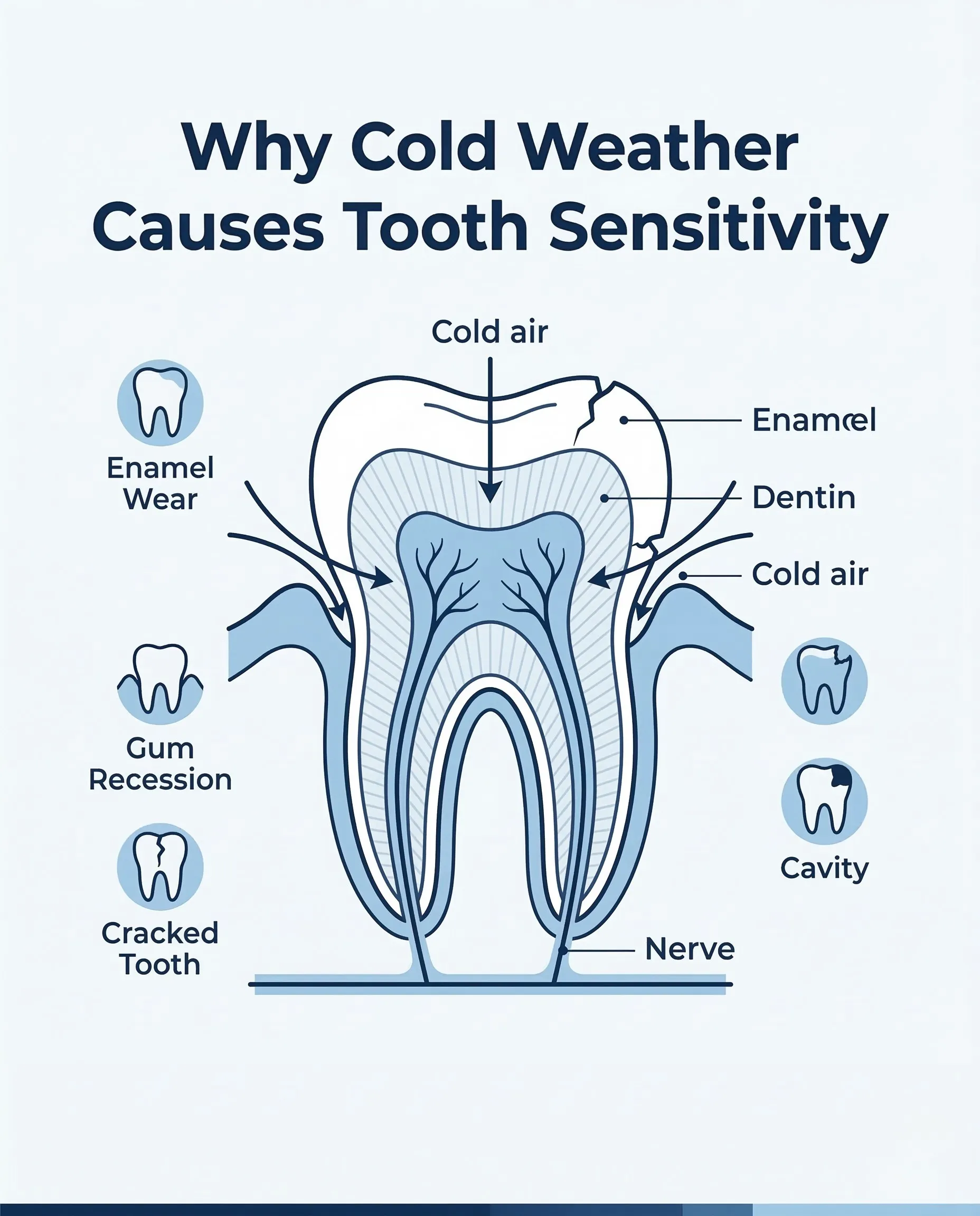 Cold Air Tooth Pain Causes Cold Air Tooth Pain Causes