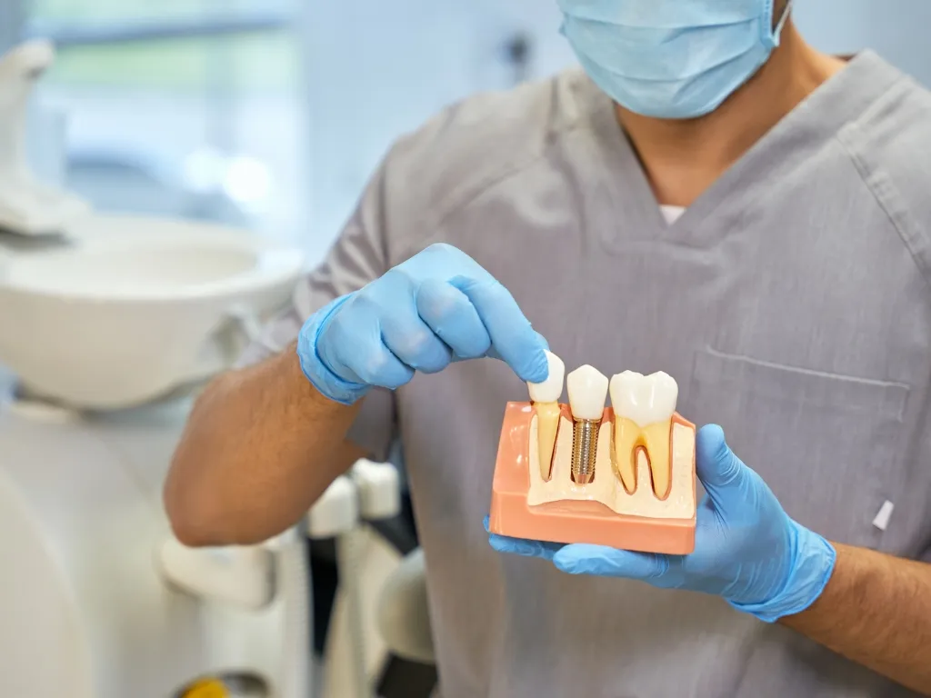 Dental Implant Procedure Dental Implant Procedure