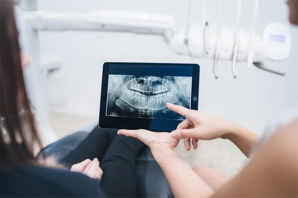 Root canal cost canada Root canal cost canada