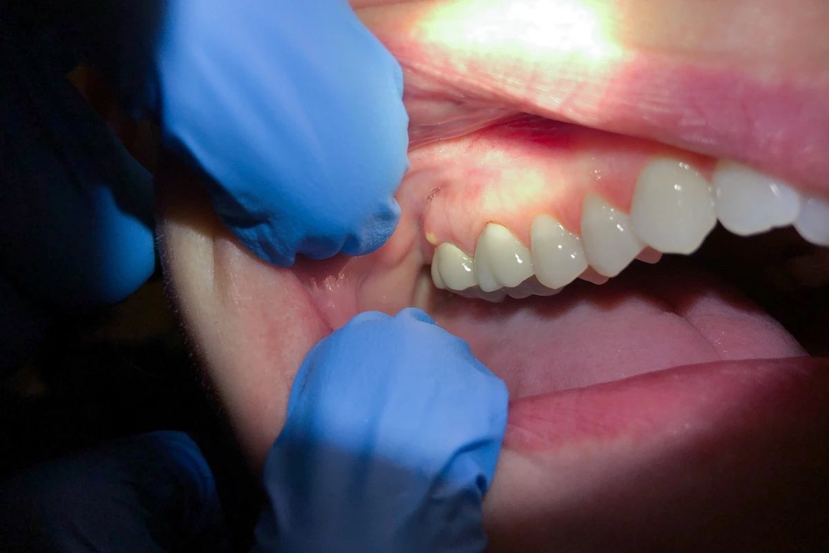 What should I do if I have a dental emergency on a Sunday night What should I do if I have a dental emergency on a Sunday night