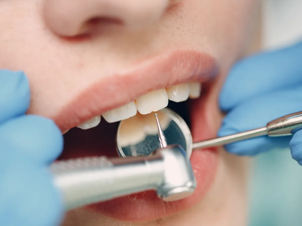Can Dentists Tell If You Vape Vaping And Oral Health: Can Dentists Tell You  Vape A Week Ago